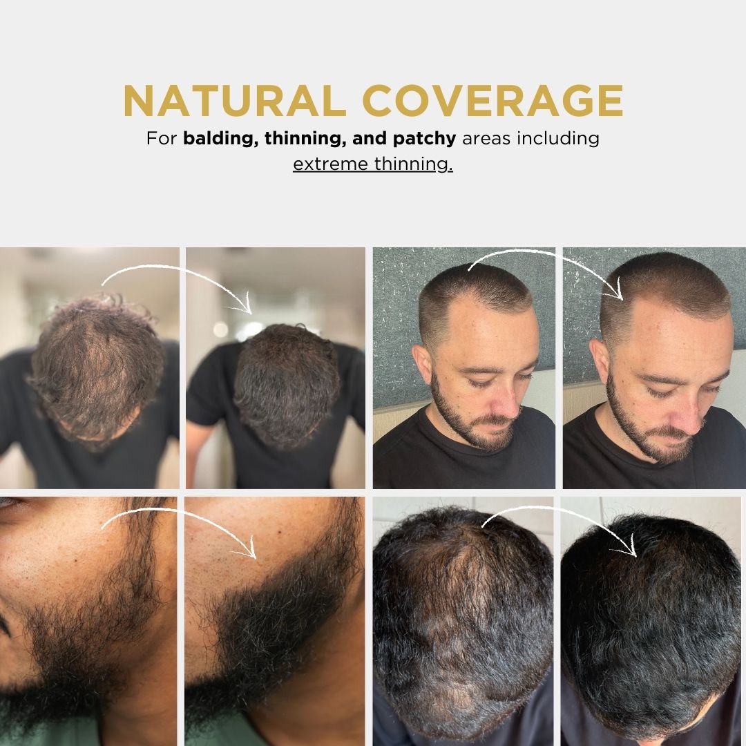 Kalveria® Hairline Powder