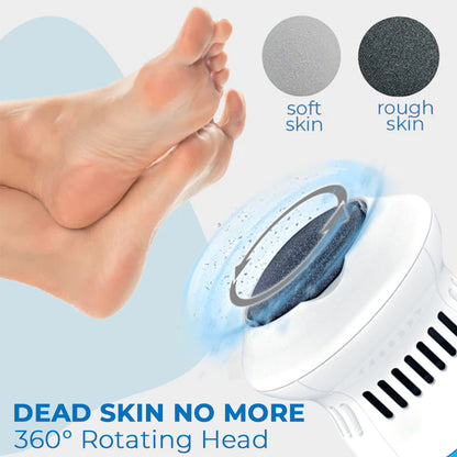 Kalveria® Vacuum Callus Remover
