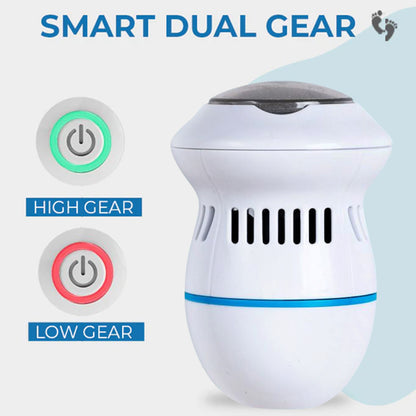 Kalveria® Vacuum Callus Remover