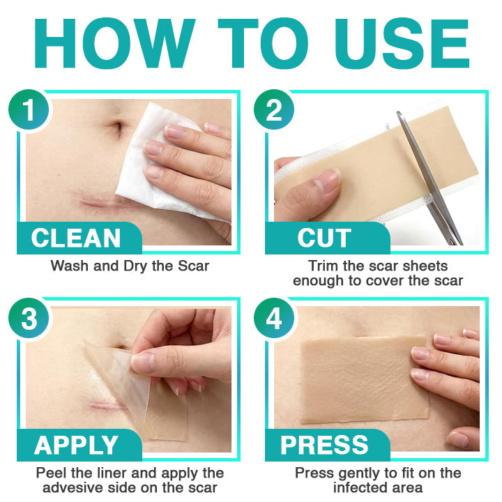 𝘾𝙖𝙧𝙚𝘽𝙧𝙚𝙚𝙯𝙚® Microneedle Scar Care Patch 🇦🇺