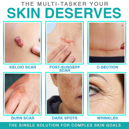 𝘾𝙖𝙧𝙚𝘽𝙧𝙚𝙚𝙯𝙚® Microneedle Scar Care Patch 🇦🇺