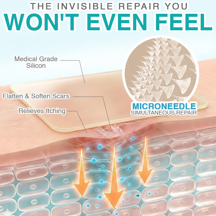 𝘾𝙖𝙧𝙚𝘽𝙧𝙚𝙚𝙯𝙚® Microneedle Scar Care Patch 🇦🇺
