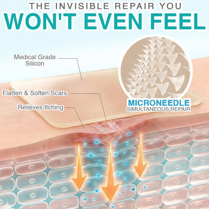 𝘾𝙖𝙧𝙚𝘽𝙧𝙚𝙚𝙯𝙚® Microneedle Scar Care Patch 🇦🇺