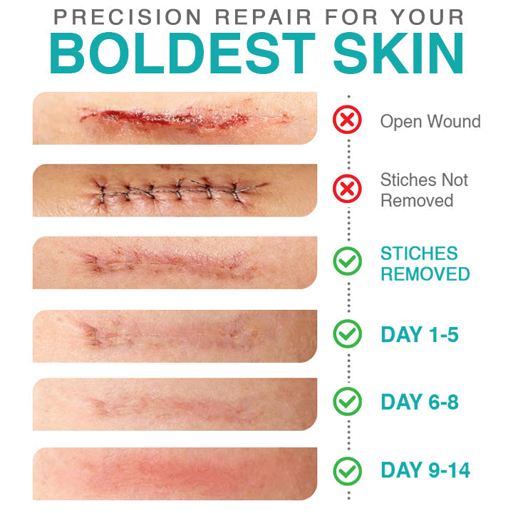 𝘾𝙖𝙧𝙚𝘽𝙧𝙚𝙚𝙯𝙚® Microneedle Scar Care Patch 🇦🇺