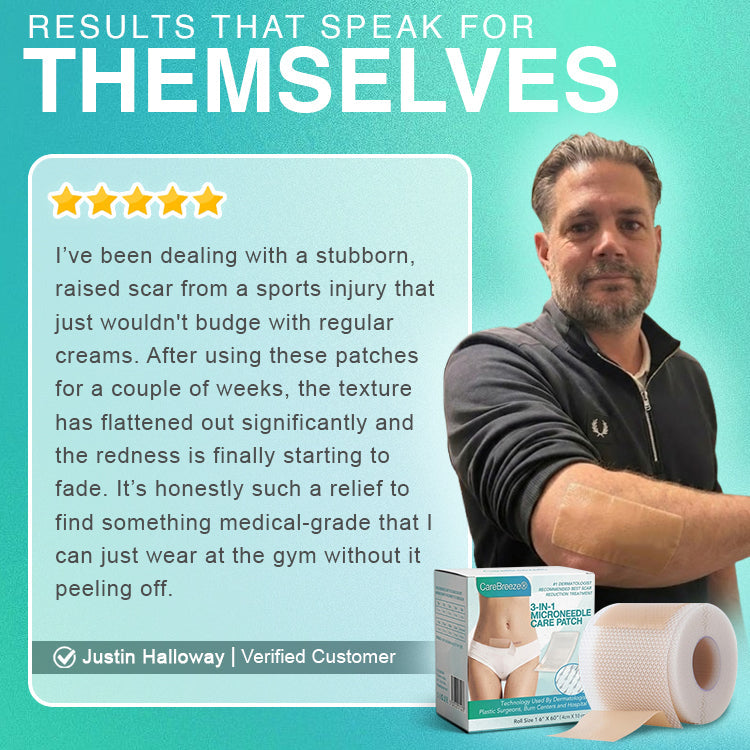 𝘾𝙖𝙧𝙚𝘽𝙧𝙚𝙚𝙯𝙚® Microneedle Scar Care Patch 🇦🇺