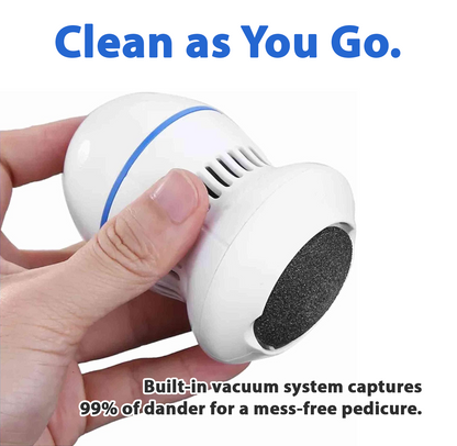 Kalveria® Vacuum Callus Remover